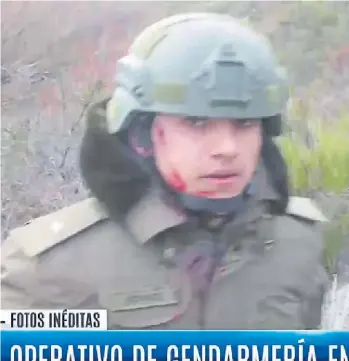 ?? CAPTURA TV ?? Heridos. Dos de los gendarmes que participar­on del operativo contra los mapuches, el 1° de agosto. Las imágenes fueron difundidas anoche por el canal América.