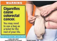  ?? THE CANADIAN PRESS/HO/HEALTH CANADA ?? The federal government is testing graphic new warnings like this one for cigarette packages.