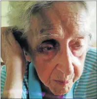  ?? Picture: SUPPLIED ?? VICIOUS ATTACK: Lily Kirchmann resident Hope Shepherd was assaulted by a caregiver at the care home in Berea