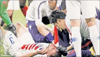  ?? Reuters ?? ON THE PITCH: Matt Miazga of the U.S. receives medial attention after hitting heads with France’s Olivier Giroud while going for a cross during the second half of the teams’ 1-1 draw on Saturday.