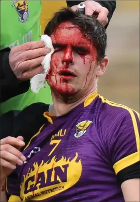  ??  ?? No gain without pain...defender Eanna Martin had to leave the fray to get treatment for this nasty cut over his right eye, sustained in the first-half of Saturday’s final.