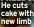  ?? ?? He cuts cake with new limb