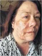  ??  ?? VICTIM Joanne Rand suffered terrible burns which lead to her death 11 days later