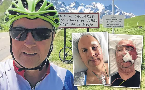  ??  ?? Main: Muirdrum cyclist Ali Simpson, 57, in France during a trip. Inset: Pictured in Ninewells Hospital with injuries to his face after the accident.