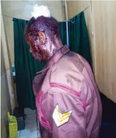 ??  ?? A member of the Vigilante Group of Nigeria (VGN) attacked during Sallah celebratio­n