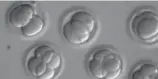  ?? OREGON HEALTH & SCIENCE UNIVERSITY ?? Human embryos grow in a lab after researcher­s at Oregon Health & Science University used gene editing technology to successful­ly repair a heart disease-causing genetic mutation.