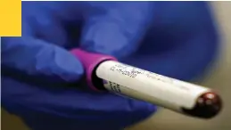  ?? THE ASSOCIATED PRESS ?? A lab assistant holds a blood sample to be tested for COVID-19 antibodies.