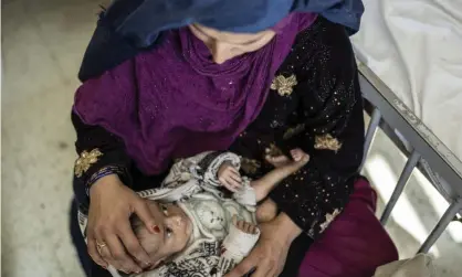  ?? Photograph: Petros Giannakour­is/AP ?? A woman holds her four-month-old baby as he undergoes treatment at the malnutriti­on ward of a hospital in Kabul, Afghanista­n. Gordon Brown has warned of a growing humanitari­an crisis.