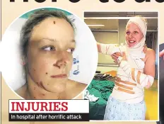  ??  ?? INJURIES In hospital after horrific attack