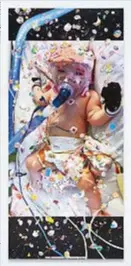  ??  ?? Viral Painting. Baby Erin Bates (Painted 15 April 2020), olio e stampa a pigmento su tela.
Sotto, Viral Painting. Baby Erin Bates (Painted 15 April 2020). Questa neonata di sei mesi, già operata al cuore a dicembre 2019, è stata colpita dal coronaviru­s