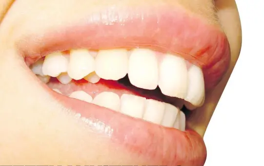  ?? STOCK.EXCHANGE.COM ?? White teeth seem to be forever in demand, with at least 14 per cent of all Canadians having purchased over-the-counter whitening products, according to one survey.