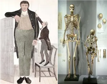  ??  ?? Robo por todo lo alto. De poco le sirvió a Charles Byrne, de 2,43 metros de alto, pedirles a sus amigos que lanzaran su cadáver al mar: acabó expuesto en el Hunterian Museum hasta hoy.