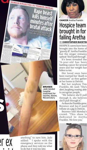  ??  ?? BRUISES Jade needed hospital treatment for injuries. Above, Record story TRIBUTE CALL Fisher