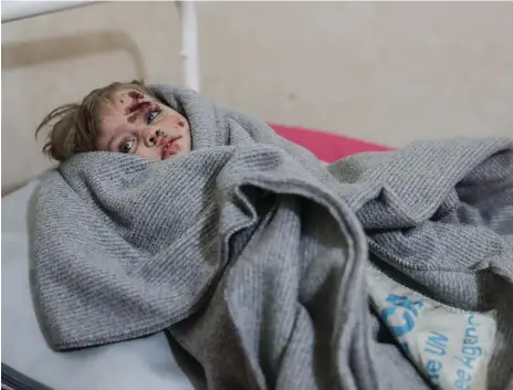  ?? EPA ?? A young girl was one of the survivors of the bombing attacks on Misraba, Eastern Ghouta, in which 19 civilians were killed