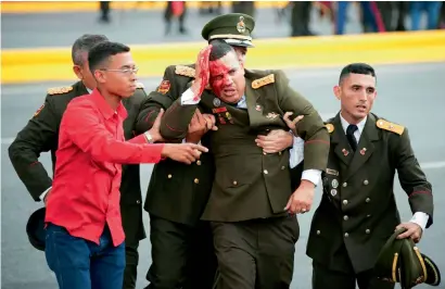  ?? — AP ?? An official bleeds from the head following the incident during a speech by Venezuela’s President Nicolas Maduro in Caracas.