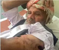  ?? AFP ?? A Kashmiri who was injured in cross-border firing by India, is treated at a hospital in the Nezapir sector on the Line of Control in Pakistan-administer­ed Kashmir on Tuesday. —
