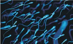  ?? GETTY IMAGES ?? One Canadian expert in human sperm pathophysi­ology says semen analysis tests are among the most poorly performed medical laboratory tests on the planet, with a margin of error as high as 50 per cent.