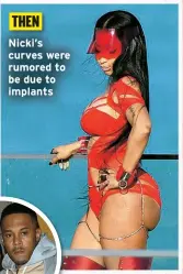  ?? ?? Nicki’s curves were rumored to be due to implants