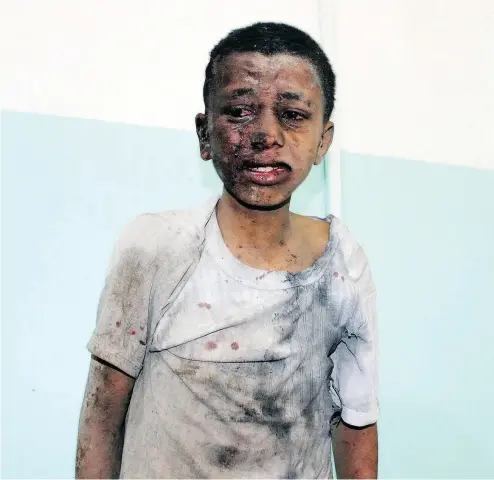  ?? STRINGER / AFP / GETTY IMAGES ?? A Yemeni child awaits treatment at a hospital after he was wounded in a reported airstrike in the province of Saada.