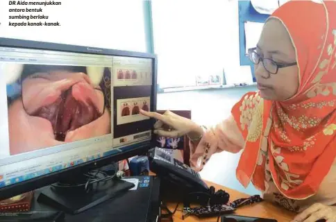  ??  ?? DR Aida menunjukka­n antara bentuk sumbing berlaku kepada kanak-kanak.