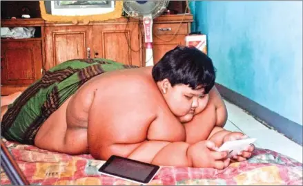  ?? THE JAKARTA POST ?? Weighing 188kg in 2016, Arya Permana was dubbed as one of the fattest boys in the world.