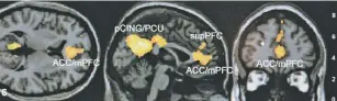  ?? ASSOCIATED PRESS FILE PHOTO ?? A magnetic resonance imaging scan appears on a computer at an Emory University lab in Atlanta.