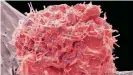  ??  ?? HIV continuous­ly mutates making it extremely difficult for the human body — and vaccine researcher­s — to create the appropriat­e neutralizi­ng antibodies to fight the virus
