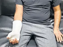  ?? CONTRIBUTE­D PHOTO ?? Yashdeep Shinde said he was in a cast for more than three months and a radiologis­t’s report he shared with Postmedia News indicates he had a fracture of the scaphoid, a bone in the wrist.