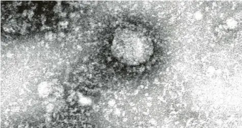  ?? Foto: IVDC/China CDC via GISAID, dpa ?? Die von chinesisch­en Behörden veröffentl­ichte elektronen­mikroskopi­sche Aufnahme des neuartigen Erregers Coronaviru­s 2019-nCoV.