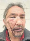  ?? ALLAN ADAM ?? RCMP charged Athabasca Chipewyan Chief Allan Adam with assault resisting arrest. He says he didn’t resist arrest.