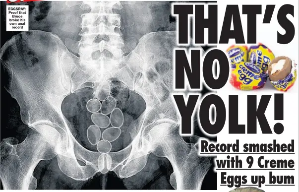  ??  ?? EGGSRAY: Proof that
Bruce broke his own anal
record