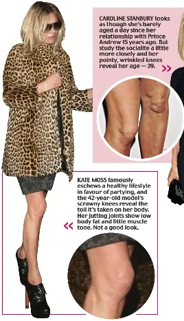 Cursed By Knobbly Knees Pressreader