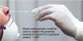  ?? — AFP ?? nasal swab samples could be used to predict the potential severity of Covid-19 in a positive patient.
