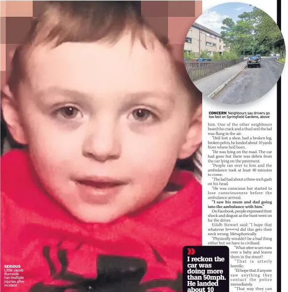  ??  ?? SERIOUS Little Jacob Burnside has multiple injuries after incident CONCERN Neighbours say drivers go too fast on Springfiel­d Gardens, above