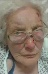  ??  ?? Eva Sutton following the attack in her home in September 2016.