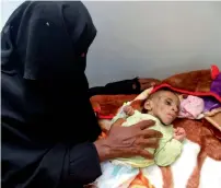 ?? AFP ?? A Yemeni woman sits next to a malnourish­ed child receiving treatment at a hospital in Hodeidah. —