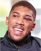  ??  ?? Shiner: Anthony Joshua