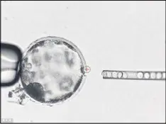  ?? SALK INSTITUTE VIA AP ?? Human stem cells are injected into a pig blastocyst. A laser beam perforates the outer membrane to allow easy access for the needle. The experiment is an early step in growing human organs inside animals.