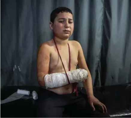  ?? © belga ?? Een gewonde jongen uit het geviseerde Maarraat Misrin. Volgens ooggetuige­n, reddingswe­rkers en internatio­nale ngo’s werden bij de aanval alleen burgerdoel­en getroffen.