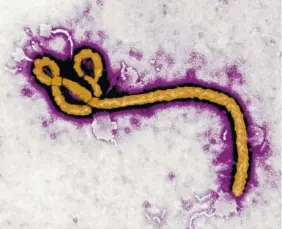  ?? THE ASSOCIATED PRESS ?? This undated colorized transmissi­on electron micrograph file image made available by the CDC shows an Ebola virus virion. Health authoritie­s are investigat­ing nine suspected cases of Ebola in a remote corner of northern Congo, including three deaths,...