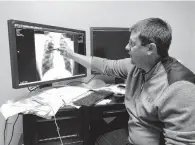  ?? DYLAN LOVAN/AP ?? Dr. Brandon Crum with an X-ray of a black lung patient at his office in Pikeville, Kentucky, in January 2019. He has seen a wave of younger miners with black lung disease at his clinic since 2015.