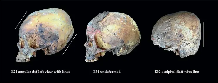  ?? TNS. ?? These skulls were found at the Huanchaqui­to-Las Llamas site in Peru where a mass child sacrifice occurred.