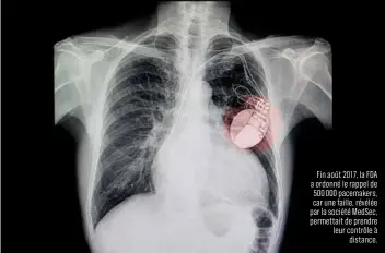  ??  ?? Fin août 2017, la FDA a ordonné le rappel de 500 000 pacemakers, car une faille, révélée par la société MedSec, permettait de prendre leur contrôle à distance.
