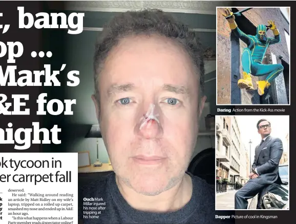  ??  ?? Ouch Mark Millar injured his nose after tripping at his home