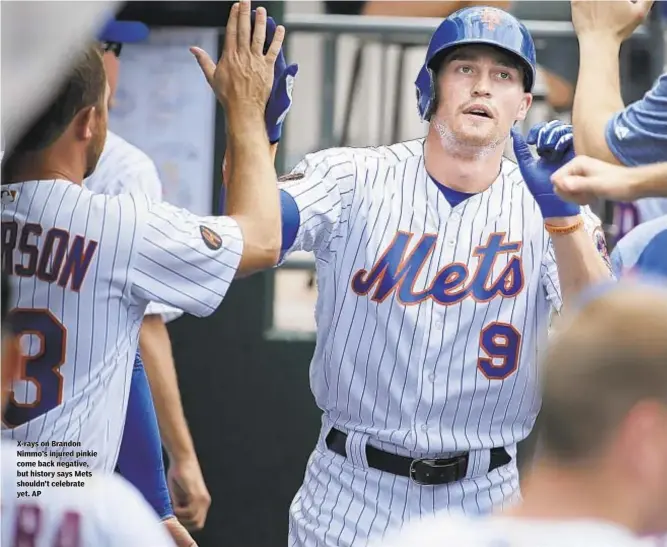  ??  ?? X-rays on Brandon Nimmo’s injured pinkie come back negative, but history says Mets shouldn’t celebrate yet. AP