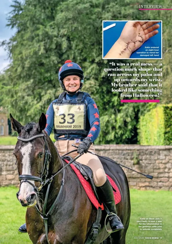  ??  ?? Katie endured an eight-hour operation to mend her damaged left hand
Katie on Black Jack V (aka Flash). It took a year for the inflammati­on in the gelding’s stifle joint to subside completely