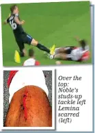  ??  ?? Over the top: Noble’s studs-up tackle left Lemina scarred (left)