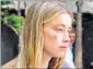  ??  ?? Actor Amber Heard appears to have a bruise on her right cheek as she leaves a downtown Los Angeles courtroom. AP