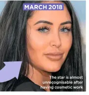  ??  ?? The star is almost unrecognis­able after having cosmetic work MARCH 2018