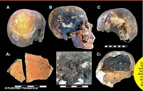  ??  ?? Scientists found traces of red (left) and black mineral (centre and right) residue on the bones, including inside skulls (right). This residue contains iron and iron oxides - chemicals that would appear when blood boils and turns into steam
